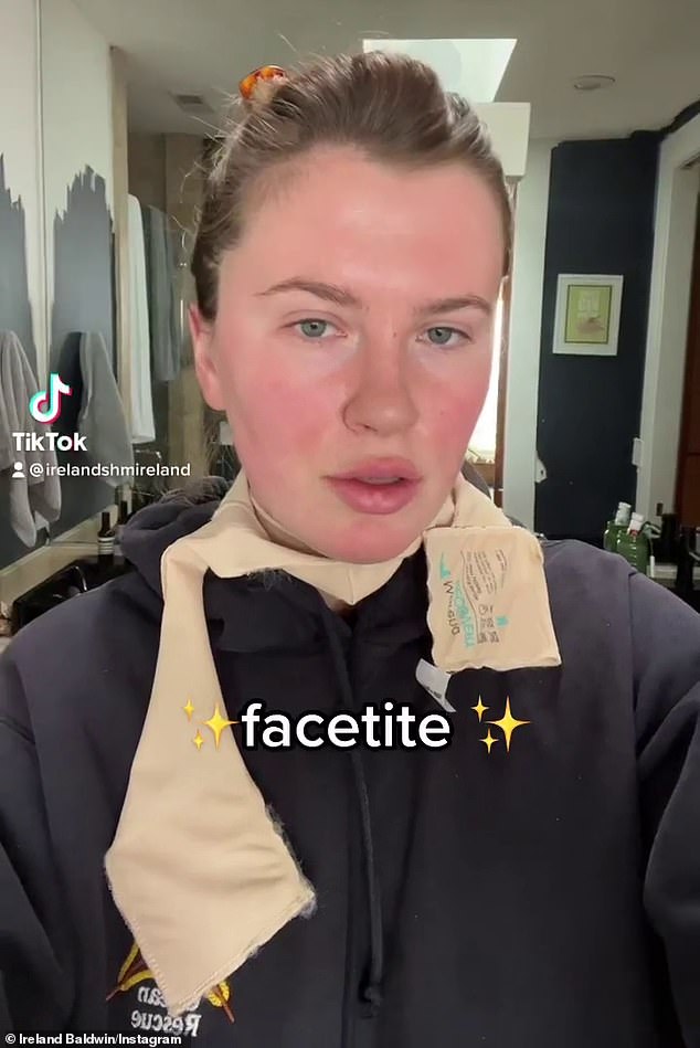 Ehrlich: Ireland Baldwin spricht darüber, warum sie sich diesen Monat FaceTite unterzieht, einem minimal-invasiven kosmetischen Verfahren, das mit einem chirurgischen Facelifting vergleichbar ist